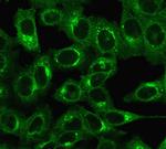 Beta-2 Microglobulin (Renal Failure and Tumor Marker) Antibody in Immunocytochemistry (ICC/IF)