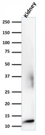 Beta-2 Microglobulin Antibody in Western Blot (WB)