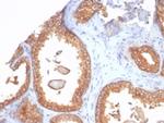 Beta-2 Microglobulin (Renal Failure and Tumor Marker) Antibody in Immunohistochemistry (Paraffin) (IHC (P))