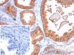 Beta-2 Microglobulin (Renal Failure and Tumor Marker) Antibody in Immunohistochemistry (Paraffin) (IHC (P))