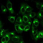 Beta-2 Microglobulin Antibody in Immunocytochemistry (ICC/IF)