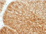 Beta-2 Microglobulin Antibody in Immunohistochemistry (Paraffin) (IHC (P))