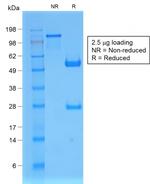 Beta-2 Microglobulin Antibody in SDS-PAGE (SDS-PAGE)