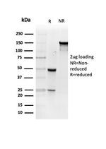 Resistin (RETN) Antibody in Immunoelectrophoresis (IE)