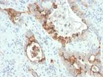 PMEPA1/TMEPAI (Tumor Suppressor Oncoprotein) Antibody in Immunohistochemistry (Paraffin) (IHC (P))