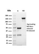 PMEPA1/TMEPAI (Tumor Suppressor Oncoprotein) Antibody in SDS-PAGE (SDS-PAGE)