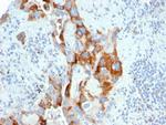 PMEPA1/TMEPAI (Tumor Suppressor Oncoprotein) Antibody in Immunohistochemistry (Paraffin) (IHC (P))