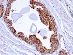 PMEPA1/TMEPAI (Tumor Suppressor Oncoprotein) Antibody in Immunohistochemistry (Paraffin) (IHC (P))