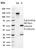 PMEPA1/TMEPAI (Tumor Suppressor Oncoprotein) Antibody in SDS-PAGE (SDS-PAGE)