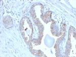 PMEPA1/TMEPAI (Tumor Suppressor Oncoprotein) Antibody in Immunohistochemistry (Paraffin) (IHC (P))