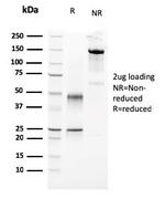 Parathyroid Hormone (PTH) Antibody in SDS-PAGE (SDS-PAGE)