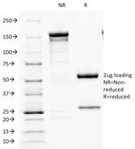 Parathyroid Hormone (PTH) Antibody in SDS-PAGE (SDS-PAGE)