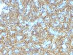 Parathyroid Hormone (PTH) Antibody in Immunohistochemistry (Paraffin) (IHC (P))