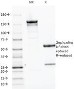 Parathyroid Hormone (PTH) Antibody in SDS-PAGE (SDS-PAGE)