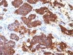 Parathyroid Hormone (PTH) Antibody in Immunohistochemistry (Paraffin) (IHC (P))