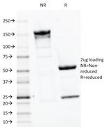 Parathyroid Hormone (PTH) Antibody in SDS-PAGE (SDS-PAGE)