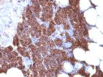 Parathyroid Hormone (PTH) Antibody in Immunohistochemistry (Paraffin) (IHC (P))