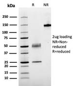 Parathyroid Hormone (PTH) (N-Terminal) Antibody in SDS-PAGE (SDS-PAGE)