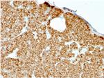 Parathyroid Hormone (PTH) (N-Terminal) Antibody in Immunohistochemistry (Paraffin) (IHC (P))