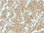 Parathyroid Hormone (PTH) (N-Terminal) Antibody in Immunohistochemistry (Paraffin) (IHC (P))