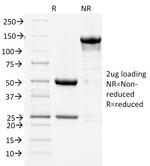 Cycloxygenase-2 (COX-2) Antibody in SDS-PAGE (SDS-PAGE)