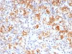 Cycloxygenase-2 (COX-2) Antibody in Immunohistochemistry (Paraffin) (IHC (P))