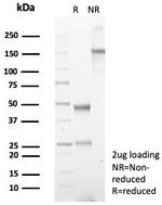 Cycloxygenase-2 (COX-2) Antibody in SDS-PAGE (SDS-PAGE)