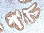 Cycloxygenase-2 (COX-2) Antibody in Immunohistochemistry (Paraffin) (IHC (P))