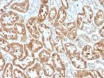 Cycloxygenase-2 (COX-2) Antibody in Immunohistochemistry (Paraffin) (IHC (P))