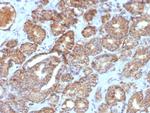 Cycloxygenase-2 (COX-2) Antibody in Immunohistochemistry (Paraffin) (IHC (P))