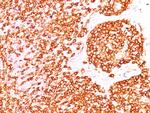 CD45RB (B-Cell Marker) Antibody in Immunohistochemistry (Paraffin) (IHC (P))