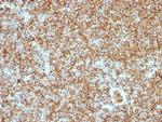 CD45RB Antibody in Immunohistochemistry (Paraffin) (IHC (P))