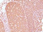 CD45RB (B-Cell Marker) Antibody in Immunohistochemistry (Paraffin) (IHC (P))