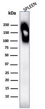 CD45RB (Leucocyte Marker) Antibody in Western Blot (WB)