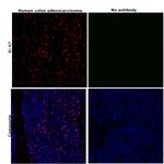 Ki-67 Antibody in Immunohistochemistry (Paraffin) (IHC (P))