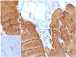 Actin alpha 1, Skeletal Muscle Antibody in Immunohistochemistry (Paraffin) (IHC (P))