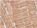 Actin alpha 1, Skeletal Muscle Antibody in Immunohistochemistry (Paraffin) (IHC (P))