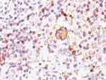 Bax (Apoptosis Marker) Antibody in Immunohistochemistry (Paraffin) (IHC (P))