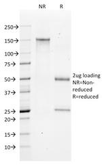 Bax (Apoptosis Marker) Antibody in SDS-PAGE (SDS-PAGE)