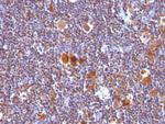 Bax (Apoptosis Marker) Antibody in Immunohistochemistry (Paraffin) (IHC (P))