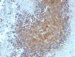 Bax Antibody in Immunohistochemistry (Paraffin) (IHC (P))