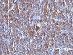 Bax Antibody in Immunohistochemistry (Paraffin) (IHC (P))