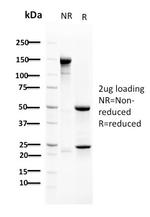 RAD51 Antibody in SDS-PAGE (SDS-PAGE)