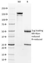 Actin, Smooth Muscle (Leiomyosarcoma Marker) Antibody in SDS-PAGE (SDS-PAGE)