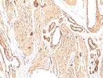 Actin, Smooth Muscle (Leiomyosarcoma Marker) Antibody in Immunohistochemistry (Paraffin) (IHC (P))