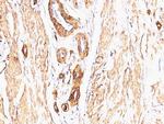 Actin, Smooth Muscle (Leiomyosarcoma Marker) Antibody in Immunohistochemistry (Paraffin) (IHC (P))