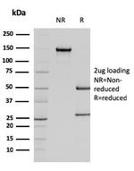 Actin, Smooth Muscle (Leiomyosarcoma Marker) Antibody in SDS-PAGE (SDS-PAGE)