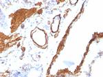 Actin, Smooth Muscle (Leiomyosarcoma Marker) Antibody in Immunohistochemistry (Paraffin) (IHC (P))