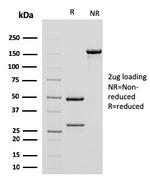 Actin, Smooth Muscle (Leiomyosarcoma Marker) Antibody in SDS-PAGE (SDS-PAGE)