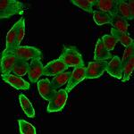 Actin, Smooth Muscle (Leiomyosarcoma Marker) Antibody in Immunocytochemistry (ICC/IF)